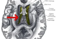 Low Birth Weight Linked to Smaller Brains and School Struggles