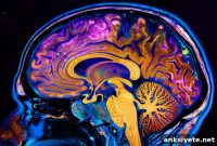 How Ketamine Alters Brain Activity