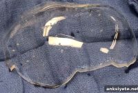Transparent Skull Implant Enables High Resolution Brain Imaging