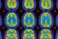 Alzheimer’s Protein Regulates Movement in Mice