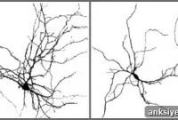 Study Finds Birth Defect Genes Linked to Mental Illness Risk