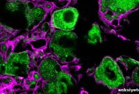 Researchers Identify New Pain Signaling Complex