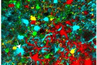 Ultrasensitive Calcium Sensors Reveal Hidden Neuronal Activity