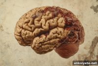 New Blood Biomarker Predicts Multiple Sclerosis Progression