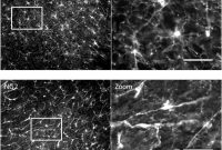 Researchers Reveal Mechanisms Guiding Brain Cell Orientation