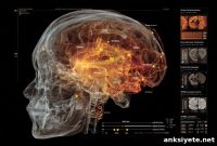 PET Scan Shows Brain Inflammation in Progressive Speech Disorder