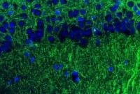 Scientists Discover Brain Circuit That Regulates Anxiety