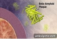 Tracking Alzheimer’s Progression Before Dementia Onset