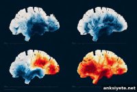 Why fMRI Often Misreads Brain Activity