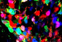 Brain Development Switch May Influence Lifelong Obesity Risk