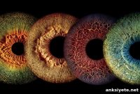 Retinal Imaging Distinguishes Alzheimer’s, Parkinson’s and More