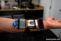 Ultrasound Wristband Maps Muscle Signals to Robotic Dexterity