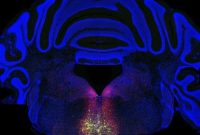 Brain Circuit Identified That Triggers Chronic Pain