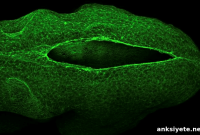 How Cellular Drawstrings Seal the Developing Brain