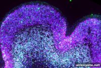How Down Syndrome Alters Early Brain Development