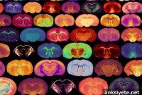 How Glucose Levels Influence Myelin Growth in the Brain