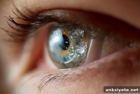 Neurostimulation Contact Lenses Rival Prozac in Depression Trial