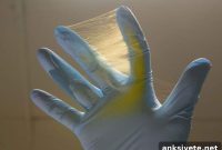 Localized Synergistic Nanofiber Therapy Could Eradicate Glioblastoma