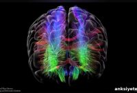 Bipolar Disorder Tied to Reduced Brain Network Efficiency