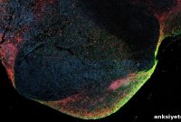 Ebola Virus Persists in Survivors’ Brains, Study Shows