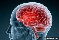 How Concussions Turn Brain Stabilizers Into Disruptors