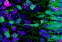 Study Reveals Repairable DNA Damage in Migrating Neurons