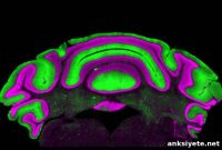 Surface EEG Signals May Mislead Movement Disorder Research