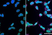 Scientists Uncover New Neuronal Death Pathway in Alzheimer’s