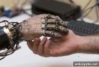 Dual Brain-Machine Interfaces Unlock Kinesthesia for Bionic Hands