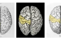 The True Identity of Carl Friedrich Gauss’s Brain