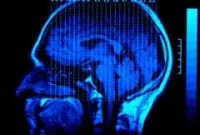 Blood Test Diagnoses Concussion, Predicts Long-Term Impairment