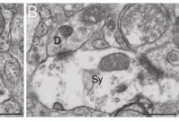 Circadian Clock Disruption Raises Neurodegeneration Risk