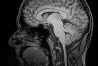 Why Recurring Memory Traces Strengthen Long-Term Memory