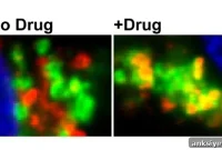 Alzheimer’s Drug Discovery: Targeting the Right ROCK Kinase