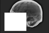 New Study Casts Doubt on Longstanding Forensic Identification Technique