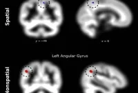 Brain Structure Predicts Number Sense