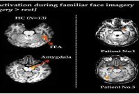 Can People in a Vegetative State Recognize Loved Ones?