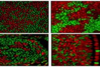 Color-Coded Cells Map X Inactivation Patterns in Female Brains