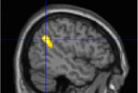 Why We Remember Dreams: What Happens in the Brain