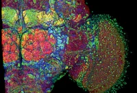 Brain Roadmap and Glossary: Navigate Neuroanatomy
