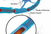 Inherited Pathway Linked to Schizophrenia Risk, New Study Shows
