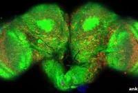 New Study Reveals Why Alzheimer’s Disrupts Sleep