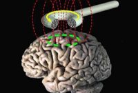 New Study Finds Brain Changes Linked to Insomnia