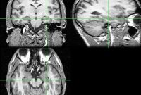 Why Our Memory Fails Without External Cues