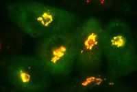 Researchers Slow Alzheimer’s Cell-Killing Plaque Growth