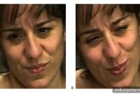 AI Detects Fake Facial Expressions of Pain Better Than Humans