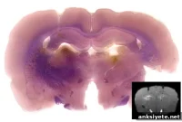 MRI Detects Gene Expression in Living Tissue