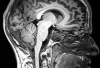 How Occasional Drug Use Affects College Students’ Brains