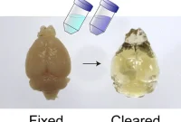 Rapid Whole-Brain Imaging at Single-Cell Resolution