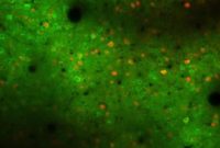 Study Finds Motor Cortex Drives Learning of Movement Patterns